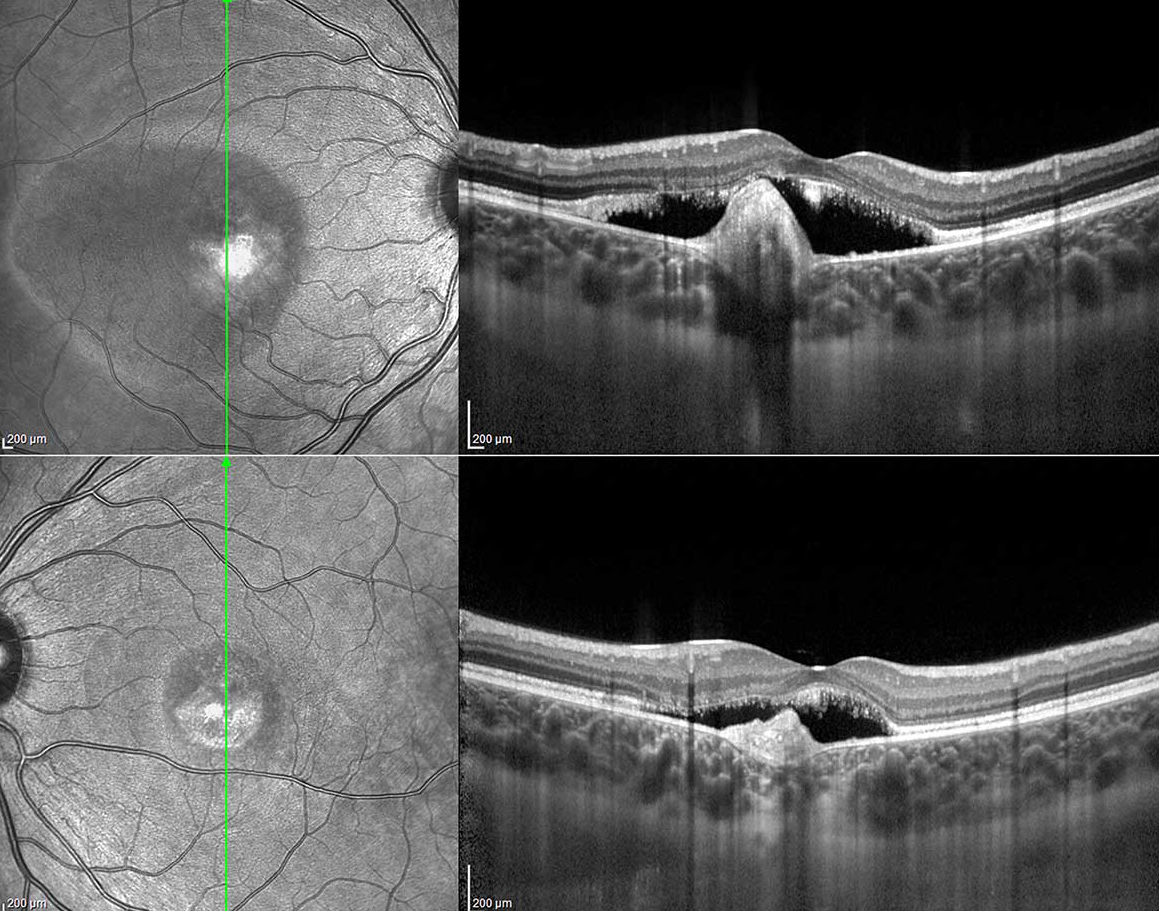 Retina scanner TACIR Ophthalmological Clinic